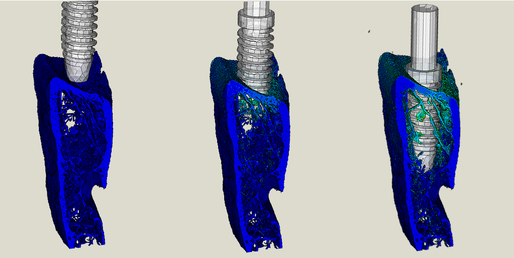 IMPLANZ - Dental Implantology Software Solutions